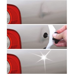 QUIXX Σετ Επισκευής Βαθουλωμάτων